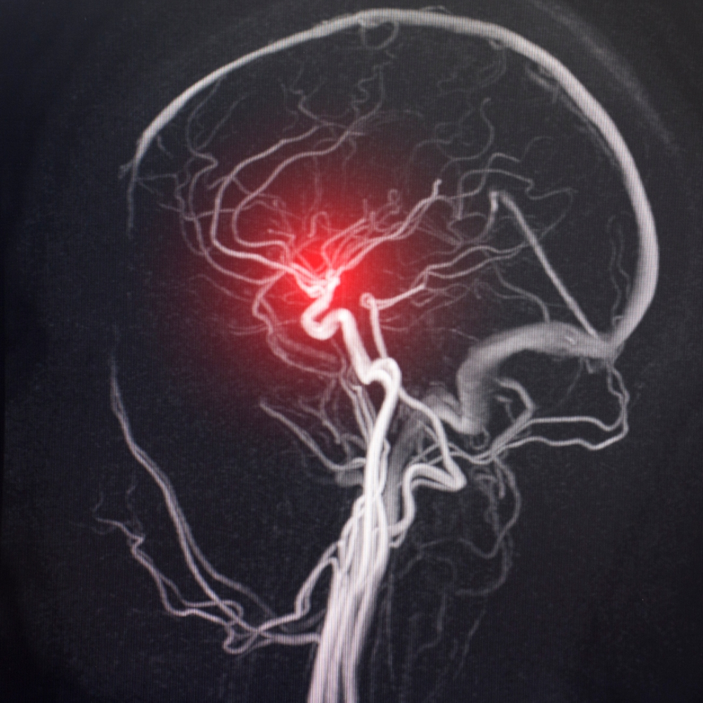 representaçãodainflamaçãopelasconexõesnervosas representação da inflamação pelas conexões nervosas